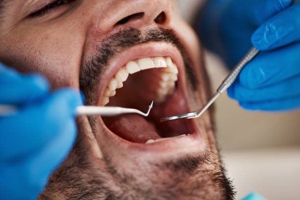 Best Emergency Broken Tooth Repair in Laware City, DE